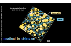 Microscopy approach offers new insights into liver disease