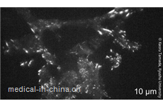 Higher-resolution imaging of cells using plasmonic metasurfaces